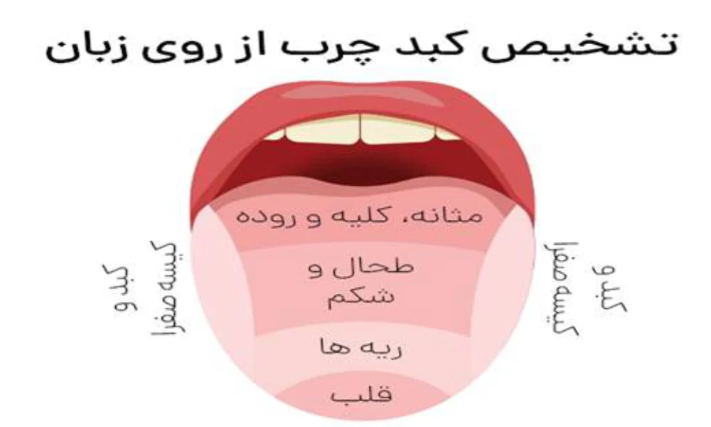 عکس زبان کبد چرب-میرصالحی
