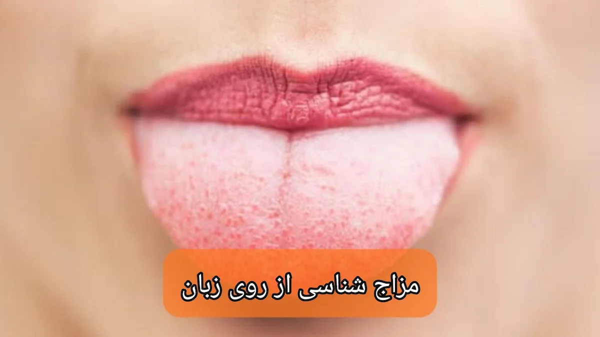 مزاج شناسی از روی زبان-میر صالحی