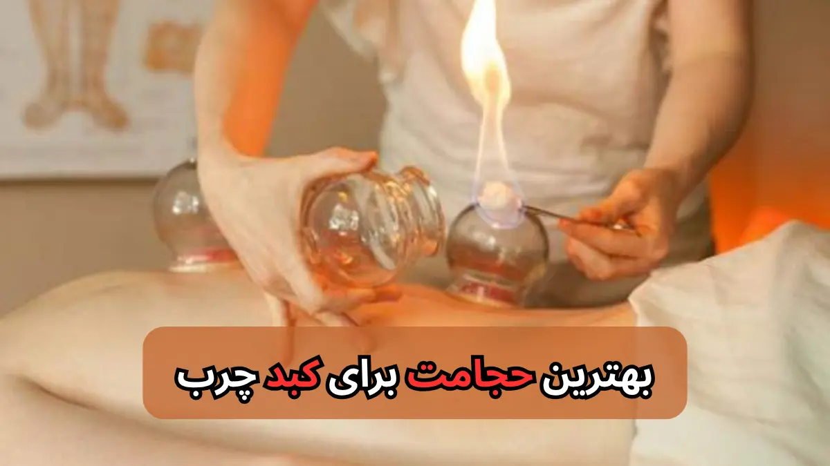 بهترین حجامت برای کبد چرب-میر صالحی