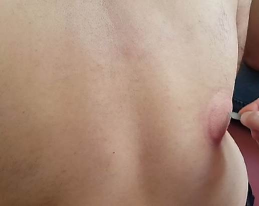 عکس محل حجامت کبد - میرصالحی