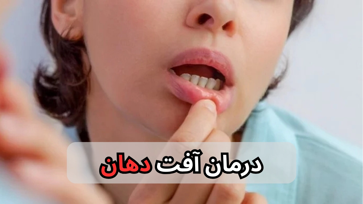 درمان آفت دهان-میر صالحی