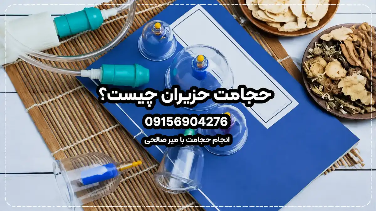 حجامت حزیران چیست؟-میرصالحی