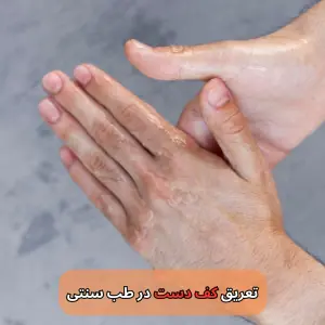 تعریق کف دست در طب سنتی - میرصالحی