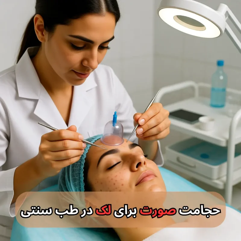 حجامت صورت برای لک در طب سنتی-میر صالحی