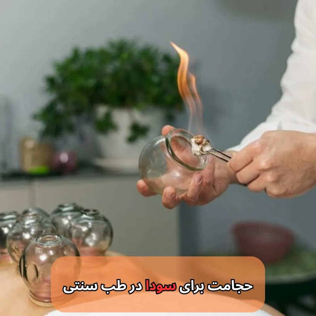 حجامت برای سودا در طب سنتی-میرصالحی