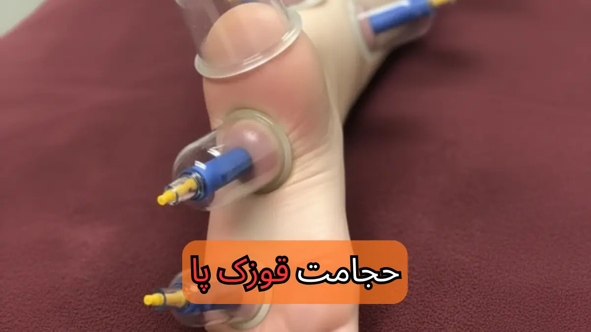 حجامت قوزک پا-میرصالحی-