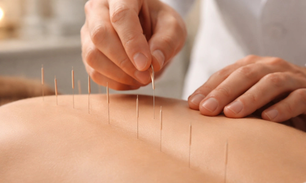 طب سوزنی برای نخاع با میرصالحی-میرصالحی