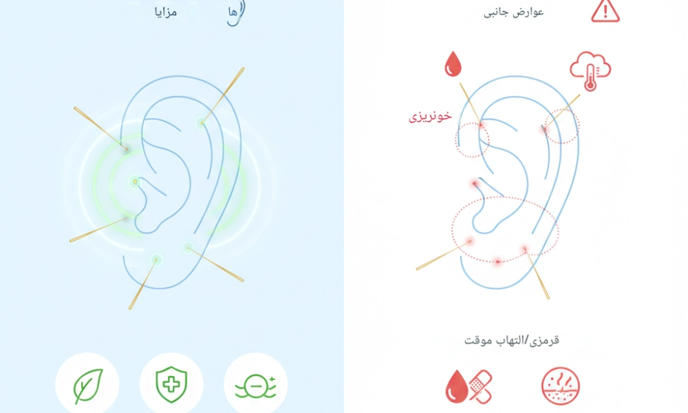 طب سوزنی برای گوش با میرصالحی-میرصالحی