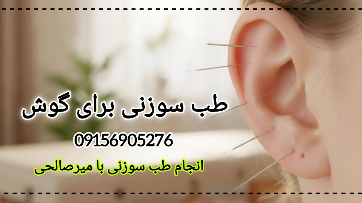 طب سوزنی برای گوش - میرصالحی