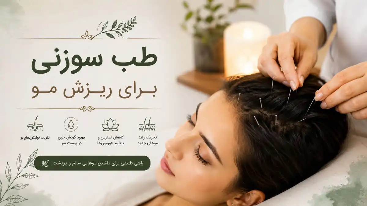طب سوزنی برای ریزش مو-میرصالحی