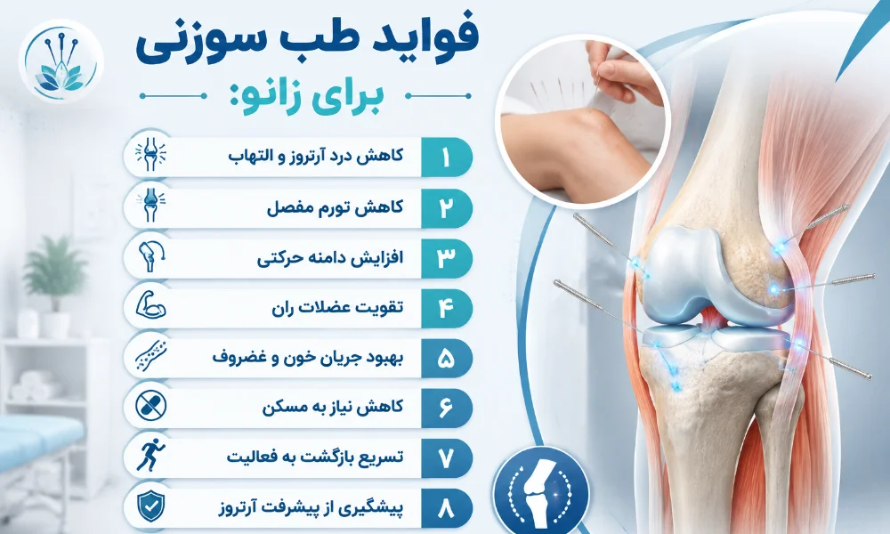 فواید طب سوزنی برای زانو-میرصالحی