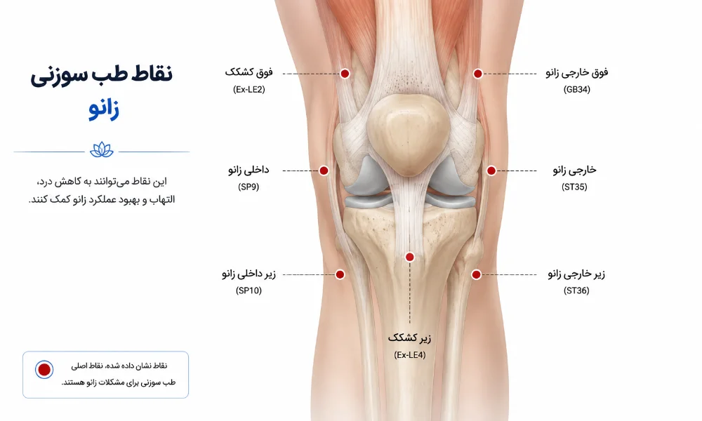 نقاط طب سوزنی زانو-میرصالحی