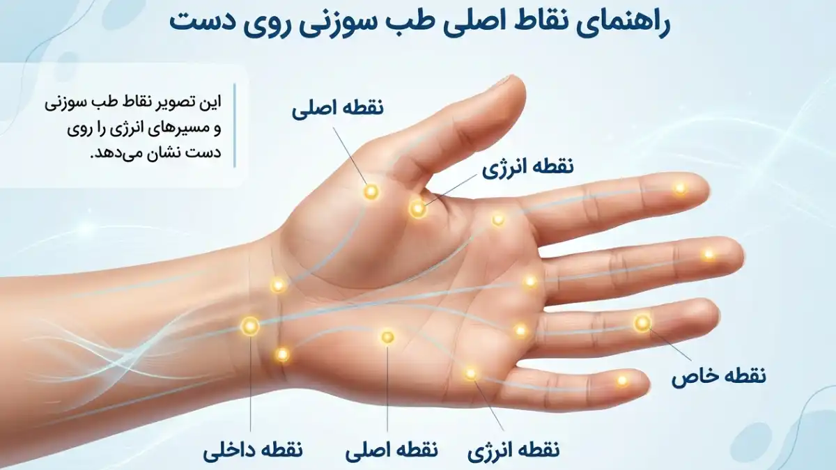 نقاط طب سوزنی دست که بیشترین کاربرد را دارند -میرصالحی