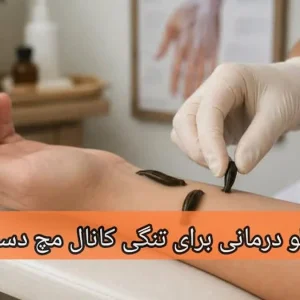 زالو درمانی برای تنگی کانال مچ دست-میرصالحی