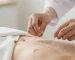طب سوزنی برای لاغری-میرصالحی