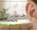 طب سوزنی برای گوش - میرصالحی