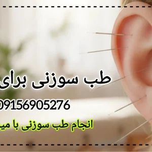 طب سوزنی برای گوش - میرصالحی
