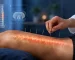 طب سوزنی ضایعه نخایی-میرصالحی
