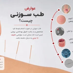 عوارض طب سوزنی چیست؟-میرصالحی